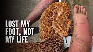 How to Survive The Most Dangerous Snake Bites - Part 3