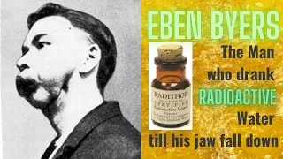 Eben Byers | The Man Who Drank Radioactive Water Until His Jaw Fell Off | Dies from Radiation