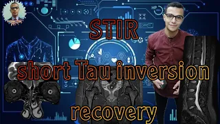 STIR ,,,short Tau inversion recovery,,,. الارتداد الانعكاسي القصير في الرنين المغناطيسي