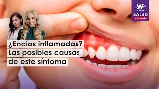 ¿Encías inflamadas? Las posibles causas de este síntoma