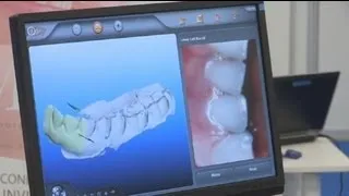 euronews hi-tech - Технология 3D в стоматологии