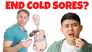 Stop Cold Sores For Good