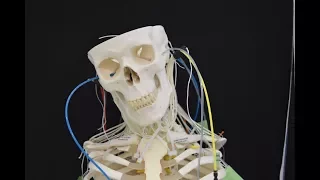 Multifilament Artificial Muscles to Mimic the Human Neck