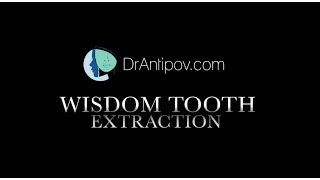 Wisdom Tooth Extraction PROMO