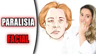 17 Dicas de Exercícios para Paralisia Facial