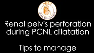 Renal pelvis perforation during PCNL dilatation - Tips to manage