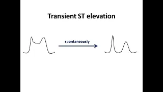 ECG course: Transient ST elevation, Dr. Sherif Altoukhy