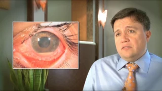 What is Uveitis? | SightMD