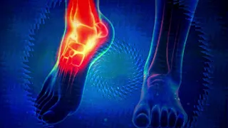 Frequency for Restless legs Syndrome (1 Hour) Binaural Cure Healing Rife Treatment Sound Therapy