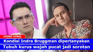 DISOROT! Penampilan Terbaru Indra Bruggman Kini Badan Kurus Wajah Pucat? Netizen Curigai Alami ini?