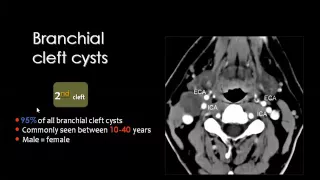 Imaging of Infrahyoid neck  Prof Dr  Mamdouh Mahfouz In Arabic