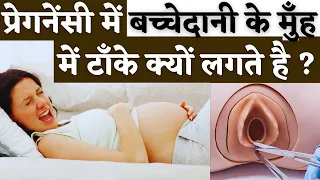 प्रेगनेंसी में बच्चेदानी के मुँह में टाँके क्यों लगते है ? Cervical Stitch in pregnancy -Youtube Mom