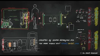 MARS (liver dialysis)