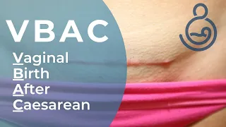 VBAC - Vaginal Birth After Caesarean