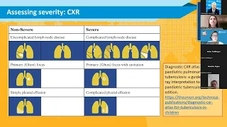 Tuberculosis treatment in children and adolescents