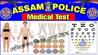 Assam Police AB UB Medical Test All Details.