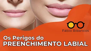 Não Faça Preenchimento Labial Sem Ver Esse Vídeo!