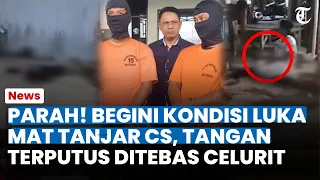 PARAH! BEGINI Luka Mat Tanjar Cs, Tangan Korban Terputus Ditebas Celurit saat Carok Maut