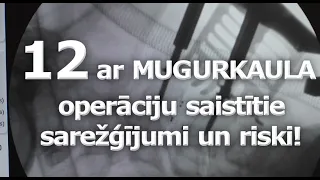 2 Daļa. Sarežģijumi un riski pēc mugurkaula operācijām