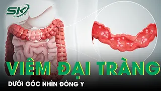 Viêm Đại Tràng Dưới Góc Nhìn Của Đông Y| SKĐS