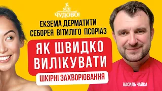 Ви не повірите! Лупа екзема псоріаз себорея дерматити та інші хвороби виліковні! Лікар Василь Чайка