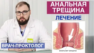 Лечение анальной трещины