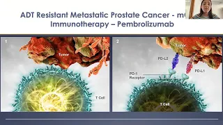 ADT Resistant Metastatic Prostate Cancer (mCRPC) - 2021 Prostate Cancer Patient Conference