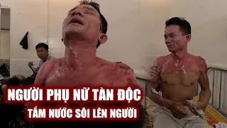 Chấn động người Đàn ông bị người phụ nữ sống chung tạt nước sôi suýt C.hết