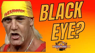 Why did Hulk Hogan have a BLACK EYE at WrestleMania 9?