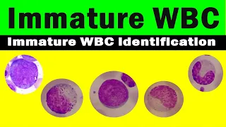 How to differentiate immature WBC | immature WBC identification | Hematology