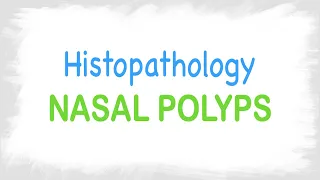 Allergic Nasal polyps Histopathology