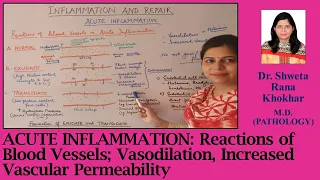 Acute Inflammation: Reactions of Blood Vessels; Vasodilation,  Increased Vascular Permeability