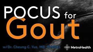 POCUS for Gout