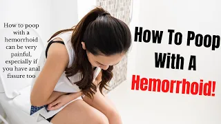 How To Poop With a Hemorrhoid