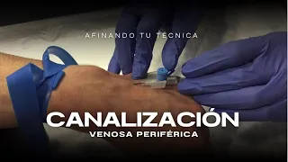 ¿Cómo CANALIZAR VENAS complicadas?