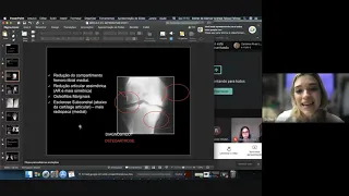 Aula de Artropatias ao Vivo 2021