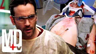 Surviving a 33 Storey Fall | Chicago Med | MD TV