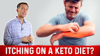 Are You Itching on a Ketogenic Diet? – Dr. Berg on Keto Rash