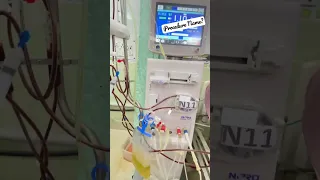 Drop Procedure Name in Comment Section? #shorts #nephrology #dialysis #ndt #Plasmapheresis #uvteam