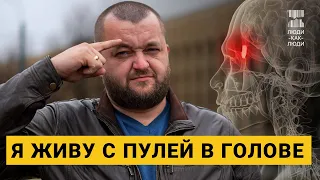 Выстрел в голову: чудом выживший милиционер 13 лет живет с пулей в голове