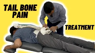 Tail bone के दर्द का सबसे अच्छा इलाज | Dr. Harish Grover Chiropractic in India