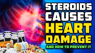 How Steroids Cause Heart Damage And How To Prevent It