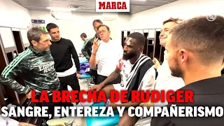 Así trataron la brecha de Rudiger en el vestuario: sangre, entereza y mucho compañerismo I MARCA