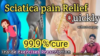 Sciatica Pain Quick Relief | 99% Result | Tamil Dr.karthikeyan
