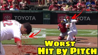 MLB | Worst Hit By Pitch May 2024