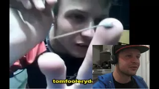 Kodie The Aussie Brony Watches His Old Videos #3 - Piercing A Blood Blister On My Fingertip