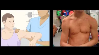 Shoulder Dislocation Reduction Technique || How to reduce Shoulder Dislocation