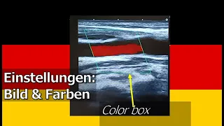 Video 10: Einstellungen vom Bild & Farben