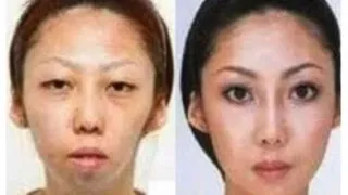 China Uncensored - Man Sues Wife Over Secret Plastic Surgery - and Wins! | NTD China Uncensored | NTDonChina