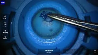 Tips for harvesting Bowman's Membrane for corneal transplantation.